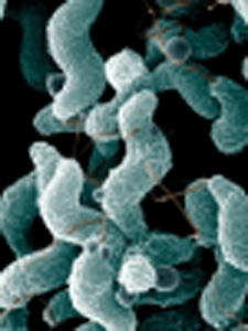 Imagen de Campylobacter jejuni