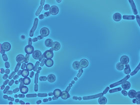 El hongo de Aspergillus produce las aflatoxinas