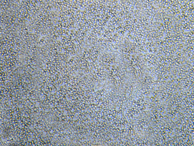 Imagen microscópica de las céluluas de Saccharomyces cerevisiae 