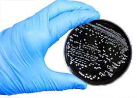  Placa de agar siendo examinada para Campylobacter